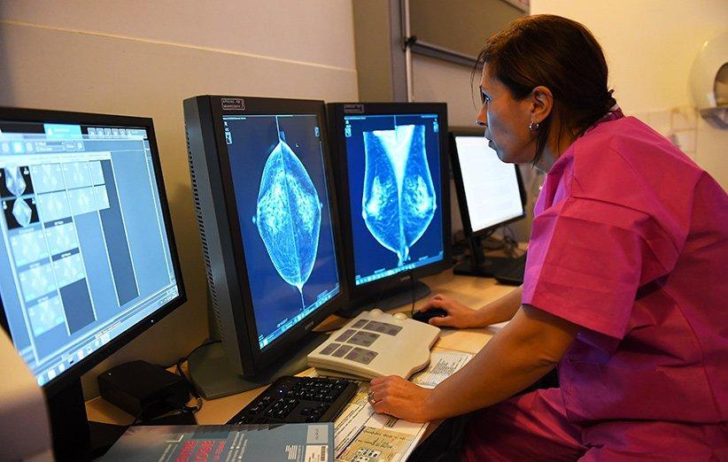 گوگل توانست انسان ها را در تشخیص سرطان سینه شکست دهد