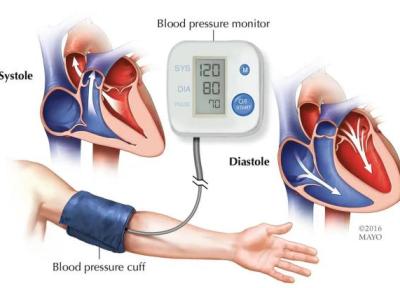 راهنمای کامل پرفشاری خون ، شرح ساده و علمی برای همه
